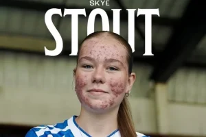 Skye Stout: Η 16χρονη που απάντησε με γκολ στο διαδικτυακό bullying