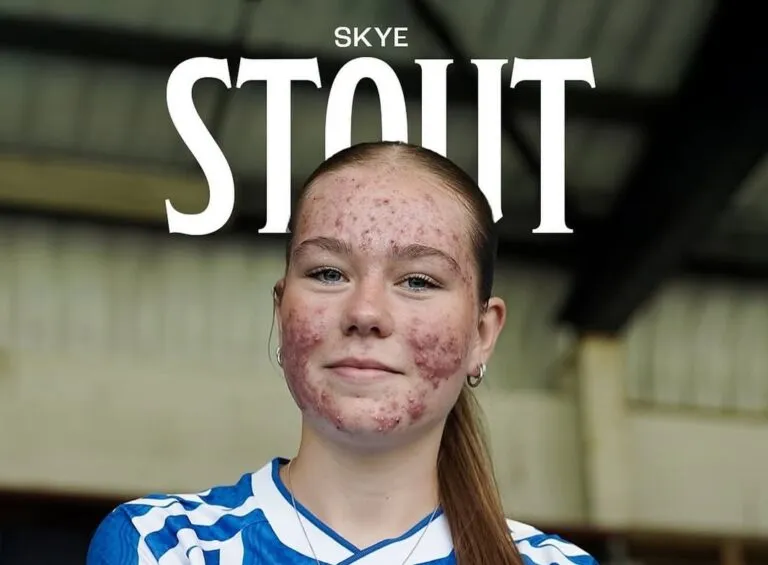 Skye Stout: Η 16χρονη που απάντησε με γκολ στο διαδικτυακό bullying