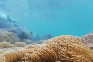 Σύρος: Στο νοσοκομείο παιδί που τσιμπήθηκε από θαλάσσια ανεμώνη – Ακόμα ένας τραυματίας