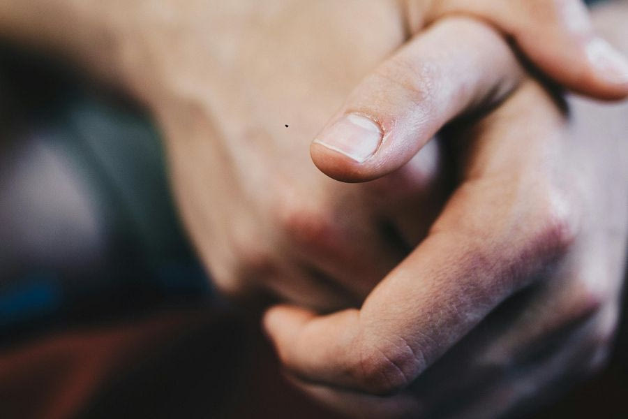 Τι σημαίνουν τα λευκά σημάδια στα νύχια σας