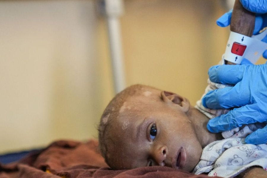 Η Ελβετία θα υποδεχτεί 20 τραυματισμένα παιδιά από τη Γάζα για ιατρική περίθαλψη