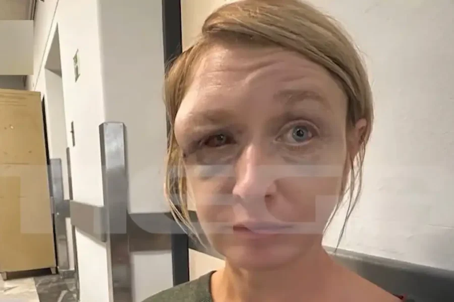 Κορωπί: «Έχουμε σχέση αγάπης με τον σύντροφό μου» λέει η 40χρονη που ξυλοκοπήθηκε – Συγκλονίζει η εικόνα της μετά την κακοποίηση