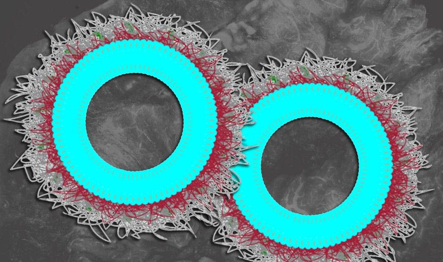 ΜΙΤ: Ερευνητές ανέπτυξαν νανοσωματίδια κατά του καρκίνου των ωοθηκών