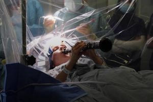 Συγκλονιστικό βίντεο: Γυναίκα με Πάρκινσον έπαιξε κλαρινέτο ενώ χειρουργούσαν τον εγκέφαλό της