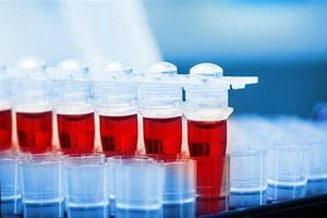 Νέα εξέταση αίματος μπορεί να ανιχνεύσει 50 τύπους καρκίνου