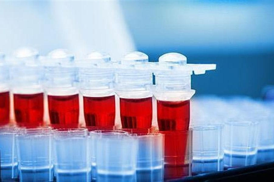 Νέα εξέταση αίματος μπορεί να ανιχνεύσει 50 τύπους καρκίνου