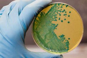 Τι συμβαίνει στις ΗΠΑ με την επιδημία λιστέριας – Ανακαλούνται έτοιμα γεύματα ζυμαρικών