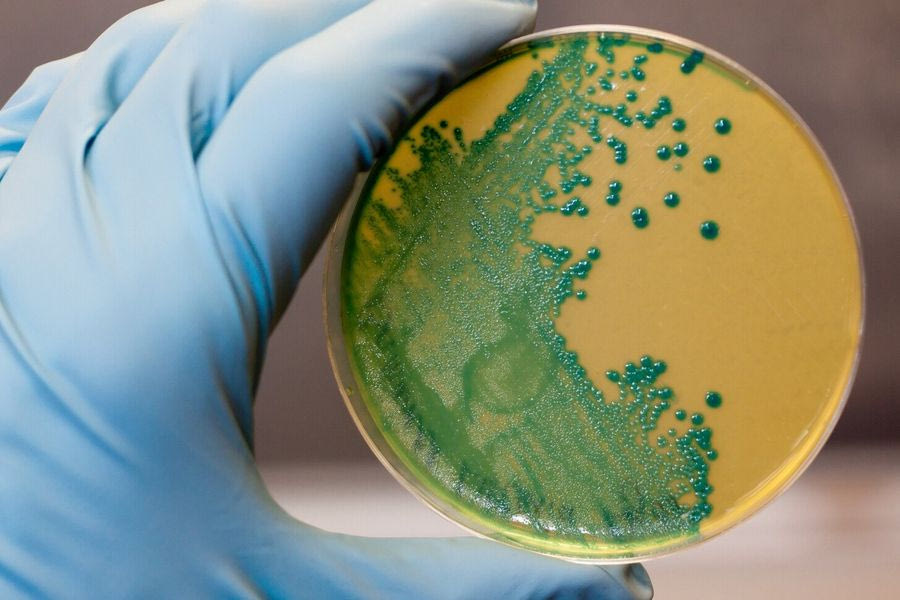 Τι συμβαίνει στις ΗΠΑ με την επιδημία λιστέριας – Ανακαλούνται έτοιμα γεύματα ζυμαρικών