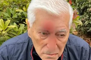 Θεσσαλονίκη: 82χρονος δέχτηκε επίθεση από γιατρό «μποξέρ»