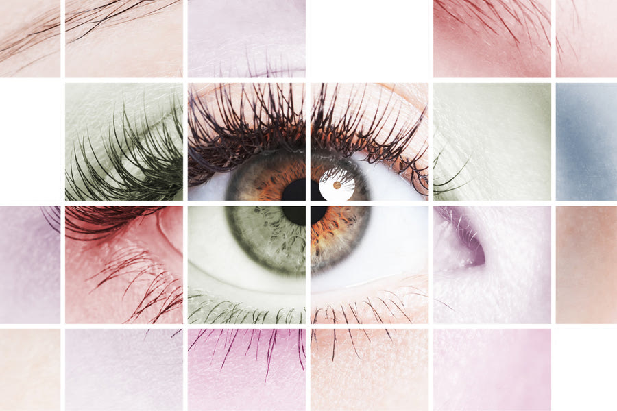 Γεγονός η πρώτη επιτυχημένη αλλαγή χρώματος ματιών στην Ελλάδα