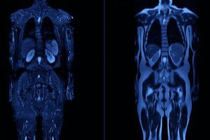 Οι ολόσωμες μαγνητικές τομογραφίες μπαίνουν στη ζωή μας