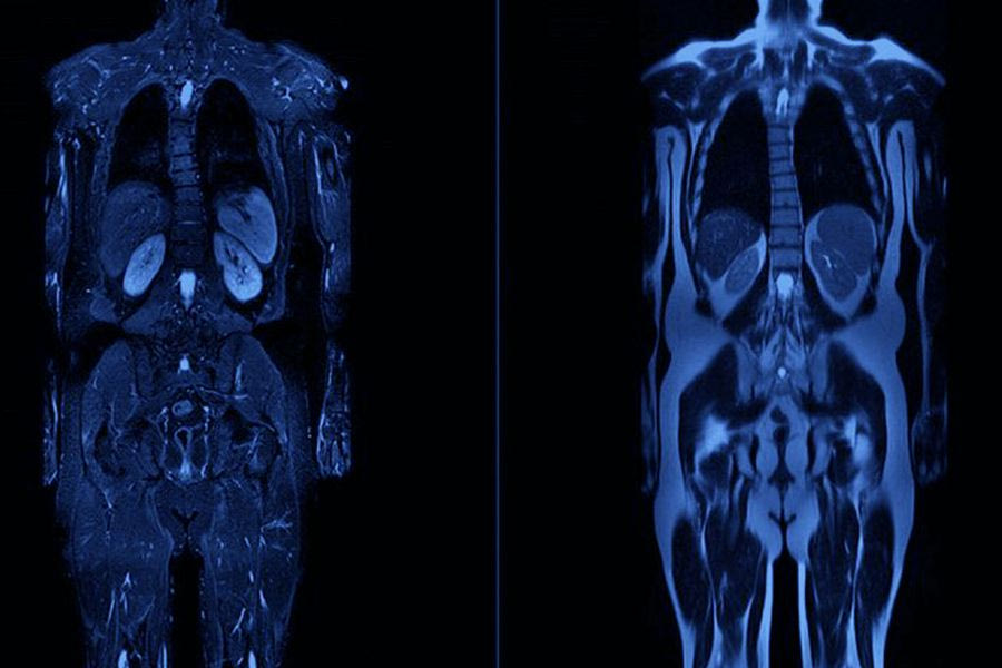 Οι ολόσωμες μαγνητικές τομογραφίες μπαίνουν στη ζωή μας