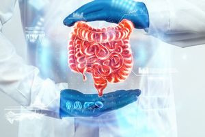 Καλπάζει ο καρκίνος του παχέος εντέρου: Πρώτη αιτία θανάτου από καρκίνο σε άτομα κάτω των 50 ετών