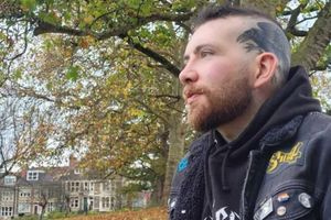 Μουσικός που έχασε τη φωνή του ξανατραγουδά χάρη στην τεχνητή νοημοσύνη