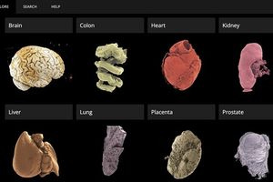 Άτλαντας οργάνων του ανθρώπινου σώματος διαθέσιμος στο διαδίκτυο