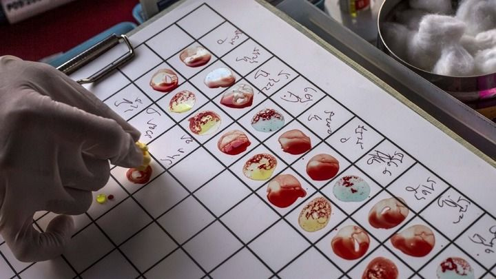 Υψηλότερα επίπεδα βιταμίνης D στο αίμα μπορεί να συνδέονται με χαμηλότερο κίνδυνο Αλτσχάιμερ