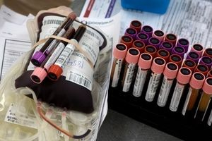 Εθελοντική αιμοδοσία στο ΑΠΘ στις 11 Μαΐου με δυνατότητα δωρεάς αιμοπεταλίων