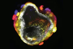 Νευρορομπότ: Η νέα γενιά «ζωντανών» μηχανών με εγκέφαλο αλλάζει τα δεδομένα στην επιστήμη