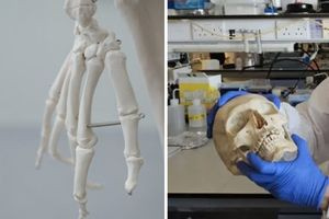 Επιστήμονες μετέτρεψαν μαλλί σε βιώσιμο υλικό για την αναγέννηση οστών