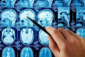 Σε υψηλό επίπεδο η Μονάδα Επεμβατικής Ακτινολογίας του ΠΑΓΝΗ