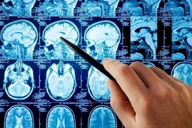 Σε υψηλό επίπεδο η Μονάδα Επεμβατικής Ακτινολογίας του ΠΑΓΝΗ