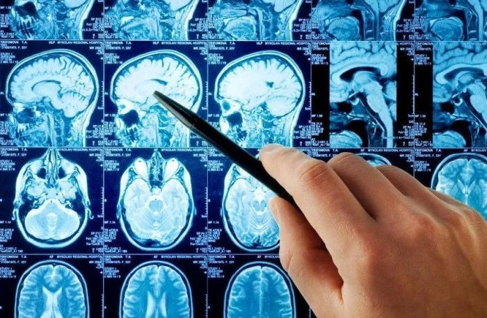 Σε υψηλό επίπεδο η Μονάδα Επεμβατικής Ακτινολογίας του ΠΑΓΝΗ