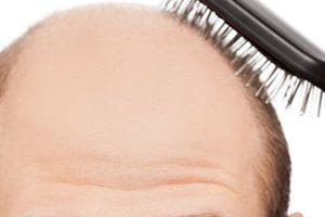 «Αντίο» στην τριχόπτωση φυτρώνουν μαλλιά σε 60 ημέρες; Πειραματική φυτική θεραπεία από την Ταϊπέι ανατρέπει τα δεδομένα