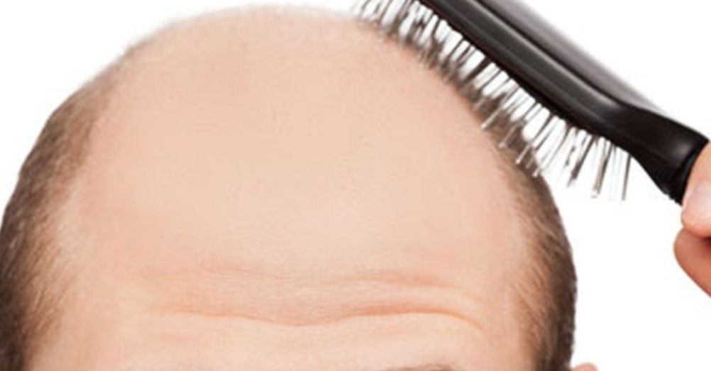 «Αντίο» στην τριχόπτωση φυτρώνουν μαλλιά σε 60 ημέρες; Πειραματική φυτική θεραπεία από την Ταϊπέι ανατρέπει τα δεδομένα