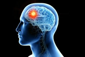 Εξατομικευμένο εμβόλιο στη μάχη για την καταπολέμηση επιθετικού καρκίνου του εγκεφάλου