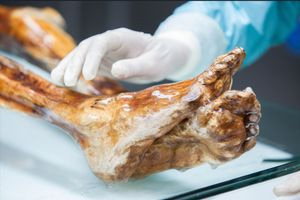 Παλαιοανθρωπολογία: Ερευνητές κατάφεραν να αποκτήσουν λεπτομερή εικόνα του μικροβιώματος του Ότζι