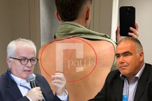 Εργασιακή βία σε ανήλικο: “Η παλάμη του βγήκε στην πλάτη μου…”, διαψεύδει ο Διευθυντής του ξενοδοχείου που αφέθηκε ελεύθερος ως το Αυτόφωρο – Καθολική καταδίκη από τους συνδικαλιστές του κλάδου