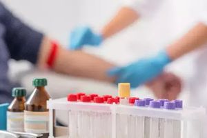 Ελπιδοφόρα εξέταση αίματος για την ανίχνευση του καρκίνου του παγκρέατος στα αρχικά στάδια