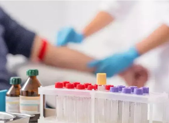 Ελπιδοφόρα εξέταση αίματος για την ανίχνευση του καρκίνου του παγκρέατος στα αρχικά στάδια