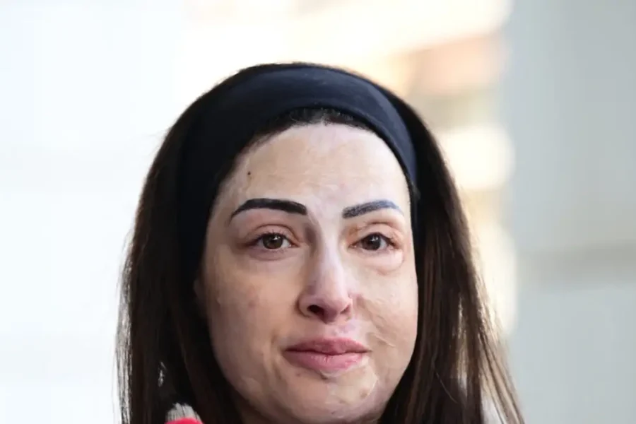 Ιωάννα Παλιοσπύρου για τυχόν αποφυλάκιση της γυναίκας που της έριξε βιτριόλι: Μου προκαλεί σοκ, είναι εγκληματίας