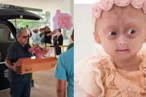 Πέθανε η Βραζιλιάνα σταρ των social media Elis Lima Carneiro σε ηλικία 5 ετών